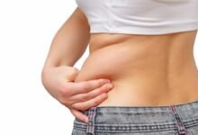Liposuction in Dubai