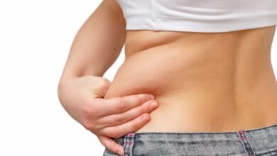 Liposuction in Dubai