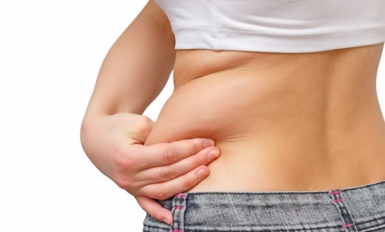 Liposuction in Dubai