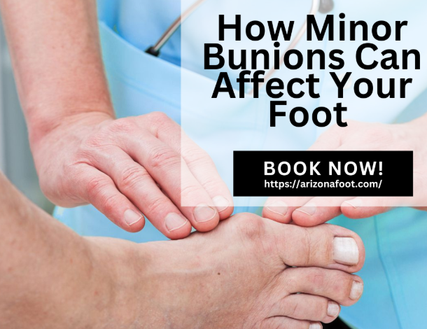 How Minor Bunions Can Affect Your Foot and What to Do About Them