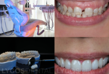 Why Istanbul Has Become the Preferred Destination for Smile Makeovers ?